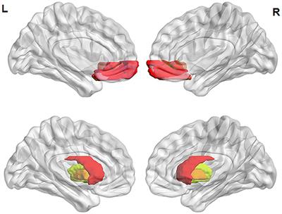 Gray Matter Abnormalities of Orbitofrontal Cortex and Striatum in Drug-Naïve Adult Patients With Obsessive-Compulsive Disorder